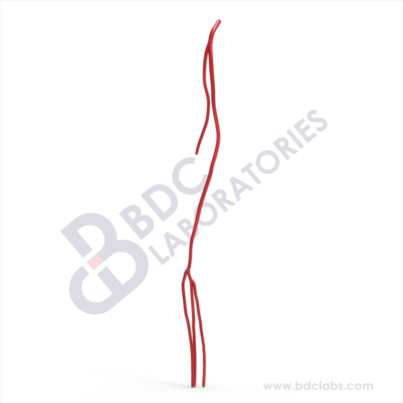 Whole Leg Arterial (SAWL-1) Image
