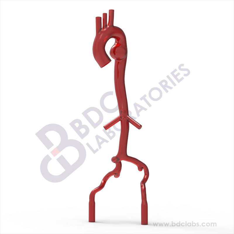 Thoracic Aneurysm Vessel (SATAA-1) Image