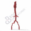 Thoracic Aortic Aneurysm - Image 2