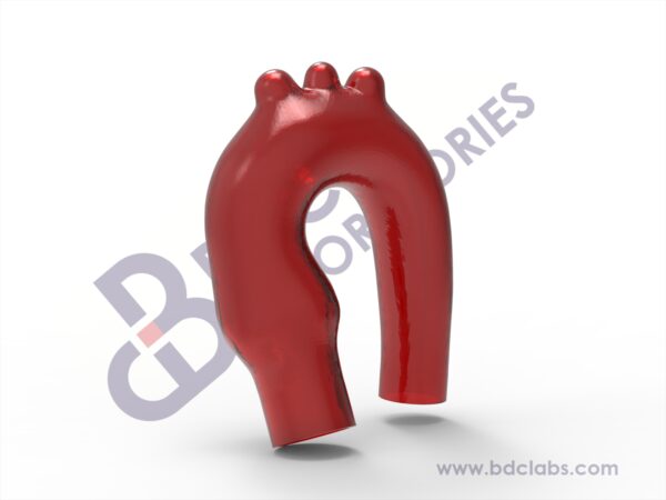 Aortic Arch