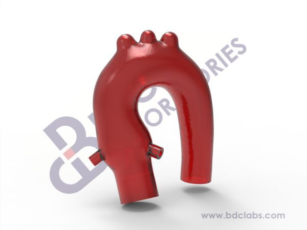 Aortic Arch with Coronary Ostia