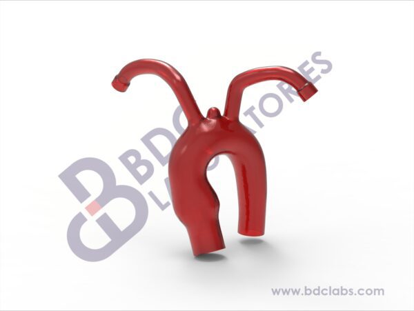 Aortic Arch with Subclavian Vessels