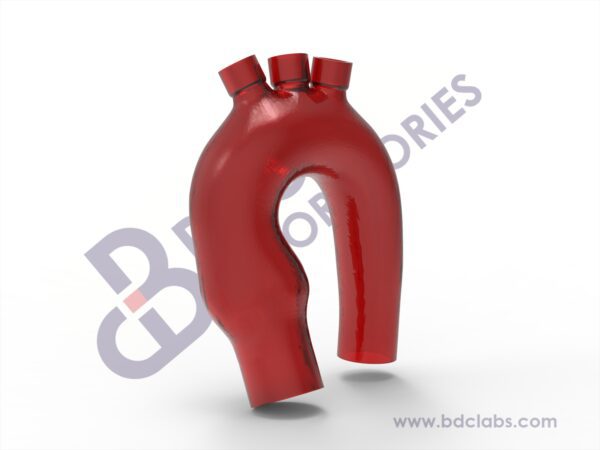 Aortic Arch with Branch Vessel Access