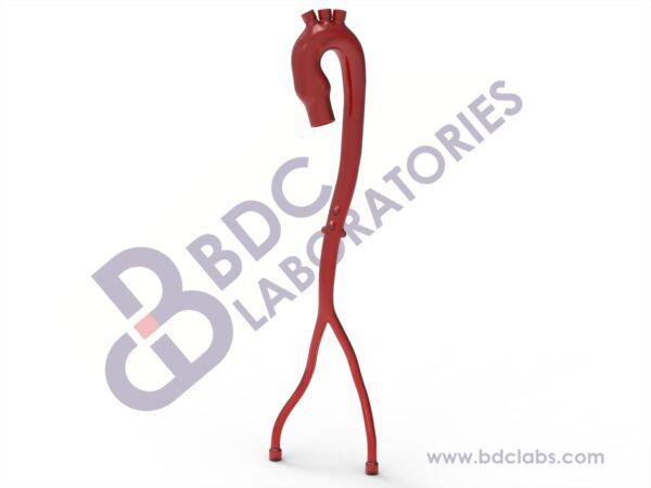 Aorta with Femoral Arteries and Branch Vessels
