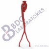 Aorta with Femoral Arteries and Branch Vessels - Image 2