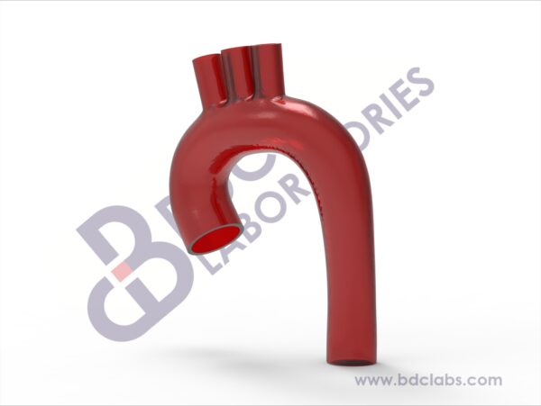 Crenel Aortic Arch