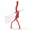 Abdominal Aortic Aneurysm - Image 2