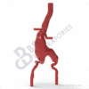 Abdominal Aortic Aneurysm - Image 2