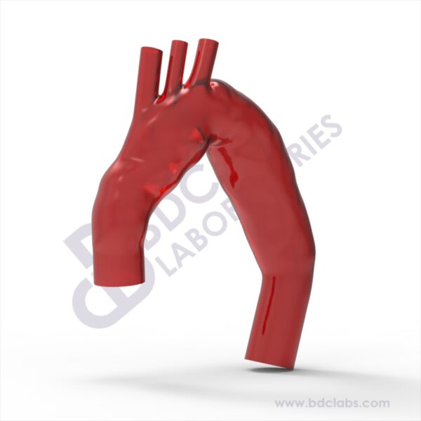 Gothic Aortic Arch