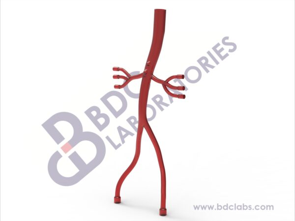 Descending Aorta with Iliac and Renal Vessels