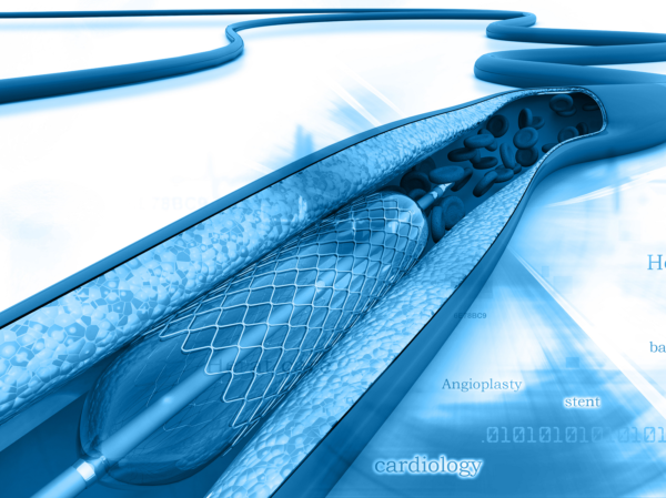 SLIC Friction Reduction Coating