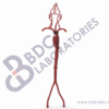 Aorta with Femoral and Neurovascular Arteries - Image 2