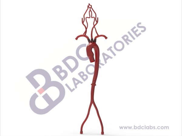 Aorta with Femoral and Neurovascular Arteries