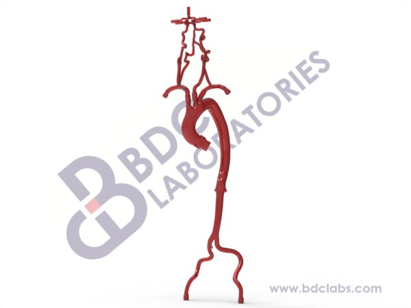 Aorta (Type III) with Femoral and Neurovascular Arteries