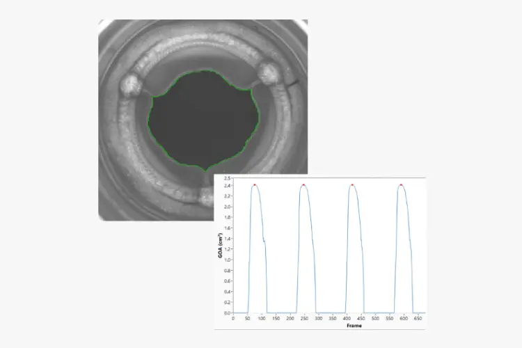 BDC Labs' Statys® GOA Heart Valve Analysis Software