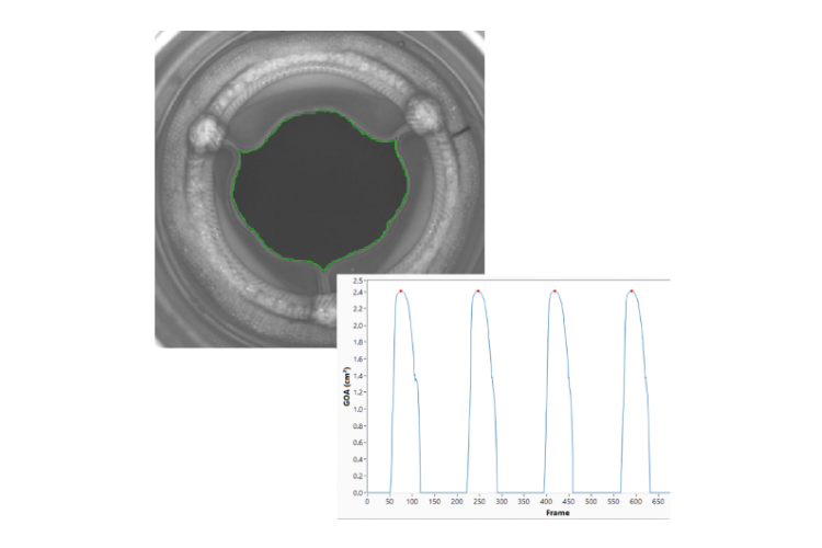 BDC Labs' Statys® GOA Heart Valve Analysis Software
