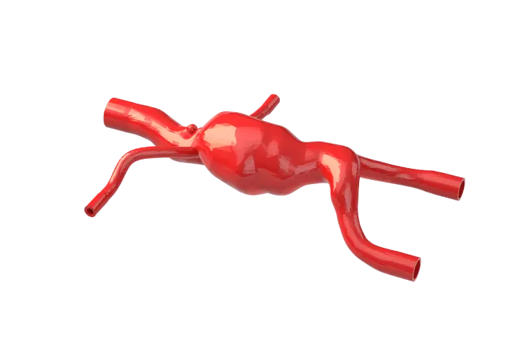 BDC anatomical silicone model without supports