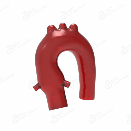 Aortic Arch with Coronary Ostia