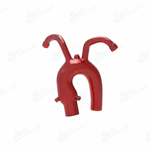 Aortic Arch with Coronary Ostia and Subclavian Vessels