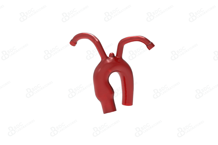 Aortic Arch with Subclavian Vessels