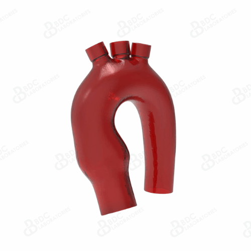 Aortic Arch with Branch Vessel Access