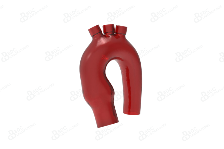 Aortic Arch with Branch Vessel Access