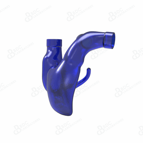 Right Heart with Pulmonary Artery and Coronary Sinus