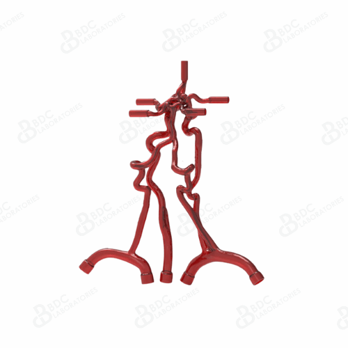 Neurovascular Arteries with Subclavian Branches & Aneurysms