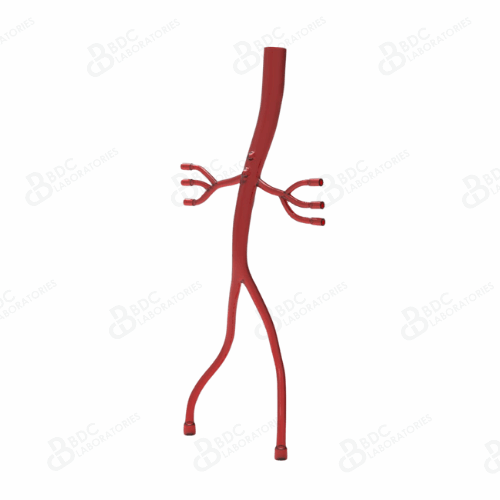 Descending Aorta with Iliac and Renal Vessels