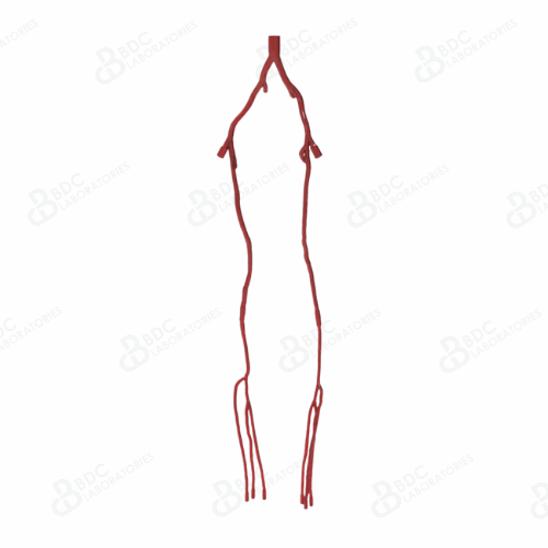 Lower Peripheral Leg Arteries