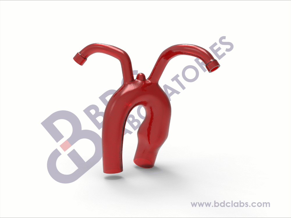 Aortic Arch with Subclavian Vessels - Image 2