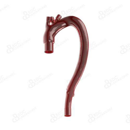 Type III Aortic Arch and Descending Aorta (Reference Document Available)